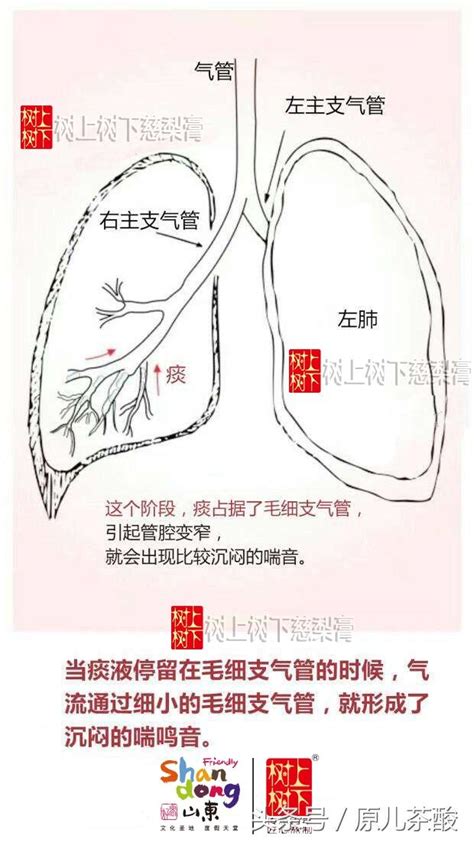 咳嗽時間|為什麼會咳嗽？ 